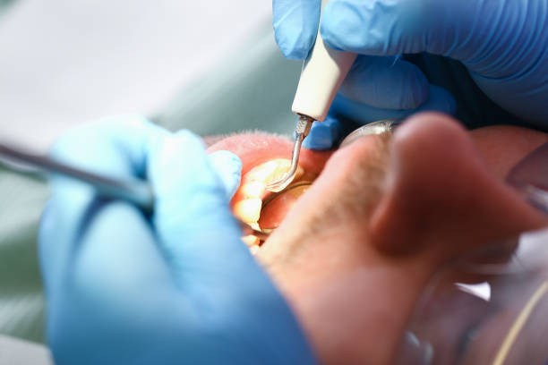 Best Emergency Broken Tooth Repair in Palo, IA